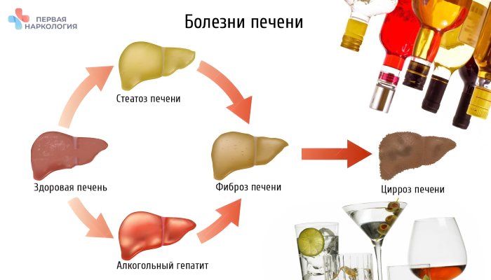 Алкоголь и печень